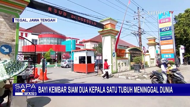 Bayi Kembar Siam Meninggal Dunia, Orangtua Bahkan Belum Sempat Beri Nama