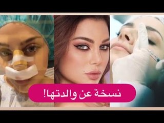 شاهدوا اول ظهور لـ ابنة هيفاء وهبي بعد التجميل !! و ابن هيفاء السري يكشف تفاصيل حصرية !!