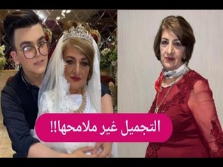 بالصور ــ جدة شهاب ملح الانستقرام تخضع لـ عمليات تجميل امام الكاميرا.. وهو يقلدها!!