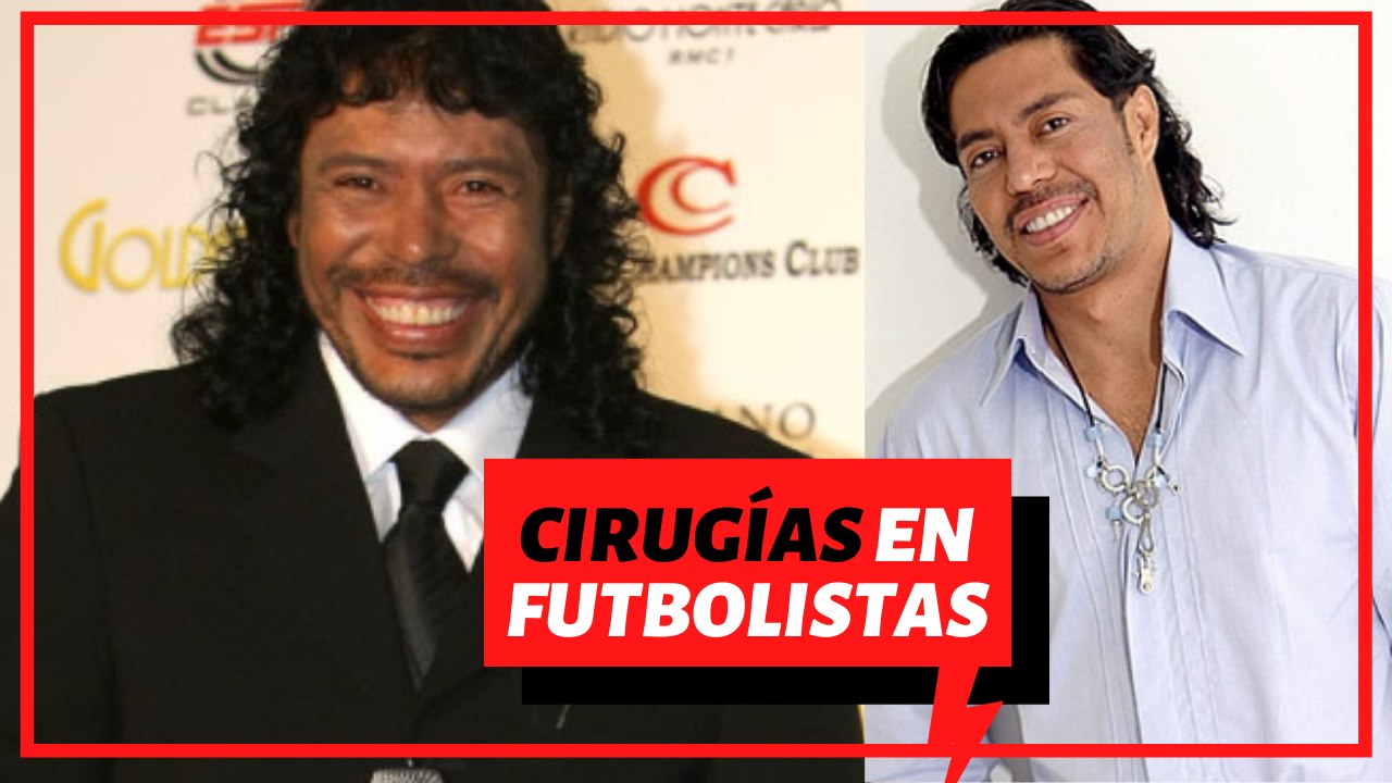 Estrellas del fútbol que se hicieron cirugía para mejorar su apariencia