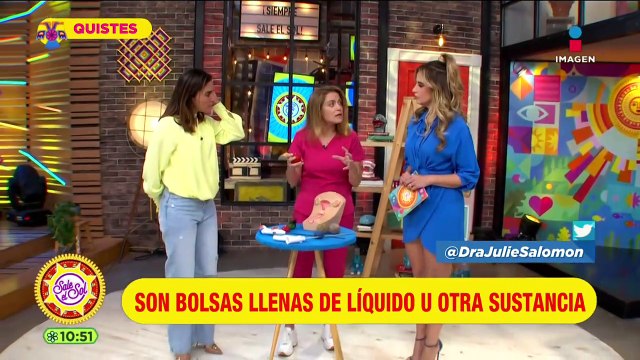 Quistes: qué son, tipos, características y cuándo es factible retirarlos