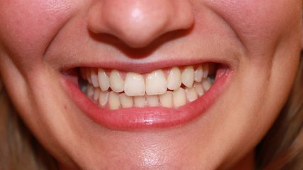 Why humans can't regrow teeth