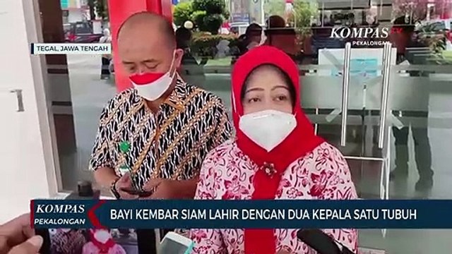 Bayi Kembar Siam Lahir dengan Dua Kepala Satu Tubuh