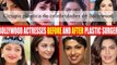 Celebridades de Bollywood antes y después de supuesta cirugía plástica