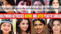 Celebridades de Bollywood antes y después de supuesta cirugía plástica