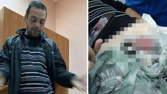 Akılalmaz intikam! Aldatılan kadın, uyuduğu sırada kocasının cinsel organına metal somun sıkıştırdı