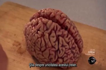 I have Einstein's brain