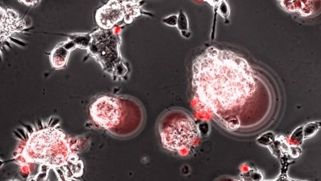 Voici les effets dévastateurs du SARS-CoV-2 sur des cellules de chauves-souris