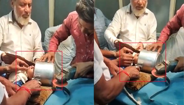 खेलते-खेलते मासूम का सिर कुकर में फंसा, दो घंटे की कड़ी मशक्कत के बाद डॉक्टर ने ऐसे बचाई जान