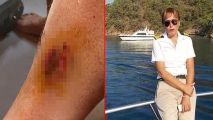 Tekne turunda denize giren kadın acılar içinde kaldı! Sudan çıkınca ayağındaki ısırığı gördü