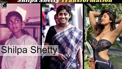 Bollywood kändisar före och efter påstådd plastikkirurgi