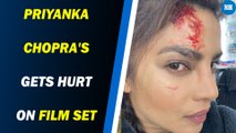 Priyanka Chopra's blood stained selfie goes viral
