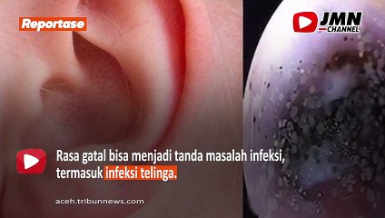 REPORTASE - TELINGA SERING GATAL ? JANGAN DI SEPELEKAN BISA JADI INI PENYEBABNYA !!