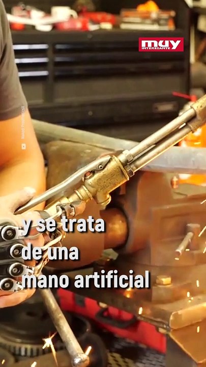 Esta prótesis le devuelve los dedos a personas que los han perdido