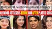 Bollywood celebrities before and after alleged plastic surgery