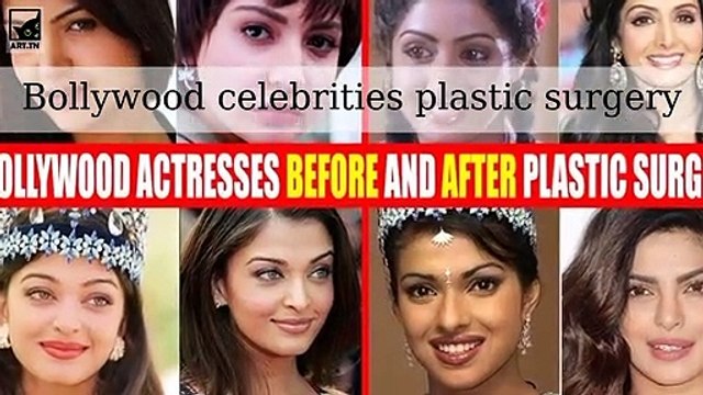 Bollywood celebrities before and after alleged plastic surgery