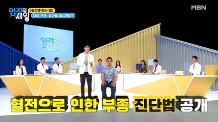 다리 부종, 혈전을 의심해라? [초간단 혈전 자가진단법]