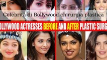Celebrità di Bollywood prima e dopo presunta chirurgia plastica