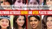 Celebridades de Bollywood antes e depois de suposta cirurgia plástica