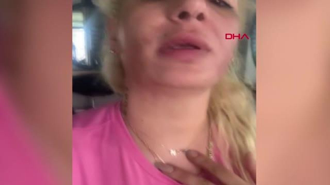 GÜZELLİK MERKEZİNDE PEELİNG YAPTIRDI, YÜZÜ YANDI