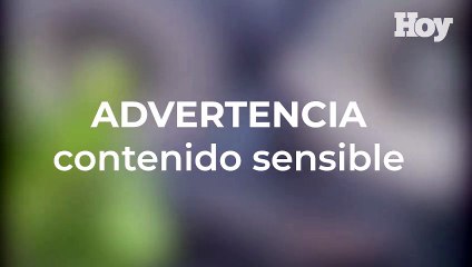 Conductor de motocicleta es arrollado por camión en la John F. Kennedy