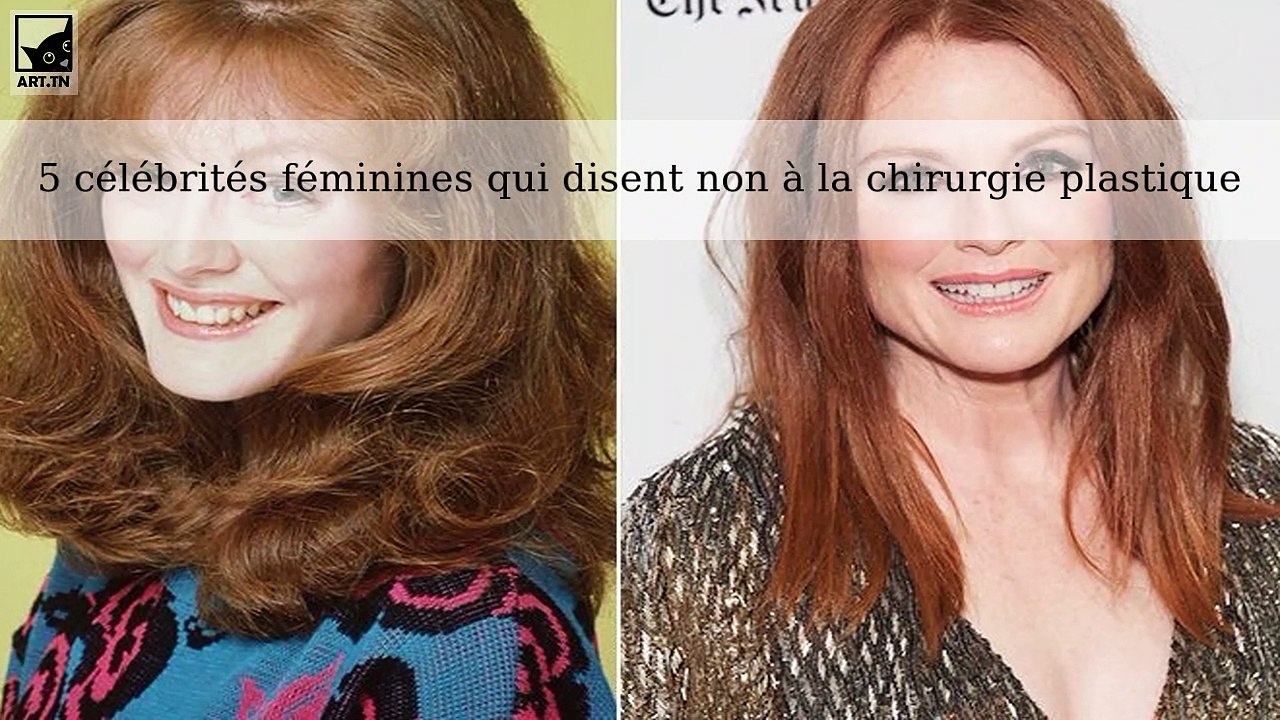 5 célébrités féminines qui disent non à la chirurgie plastique