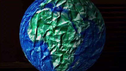 6 de Setembro - Dr Gentil Martins - Operação de separação de gémeas Siameses