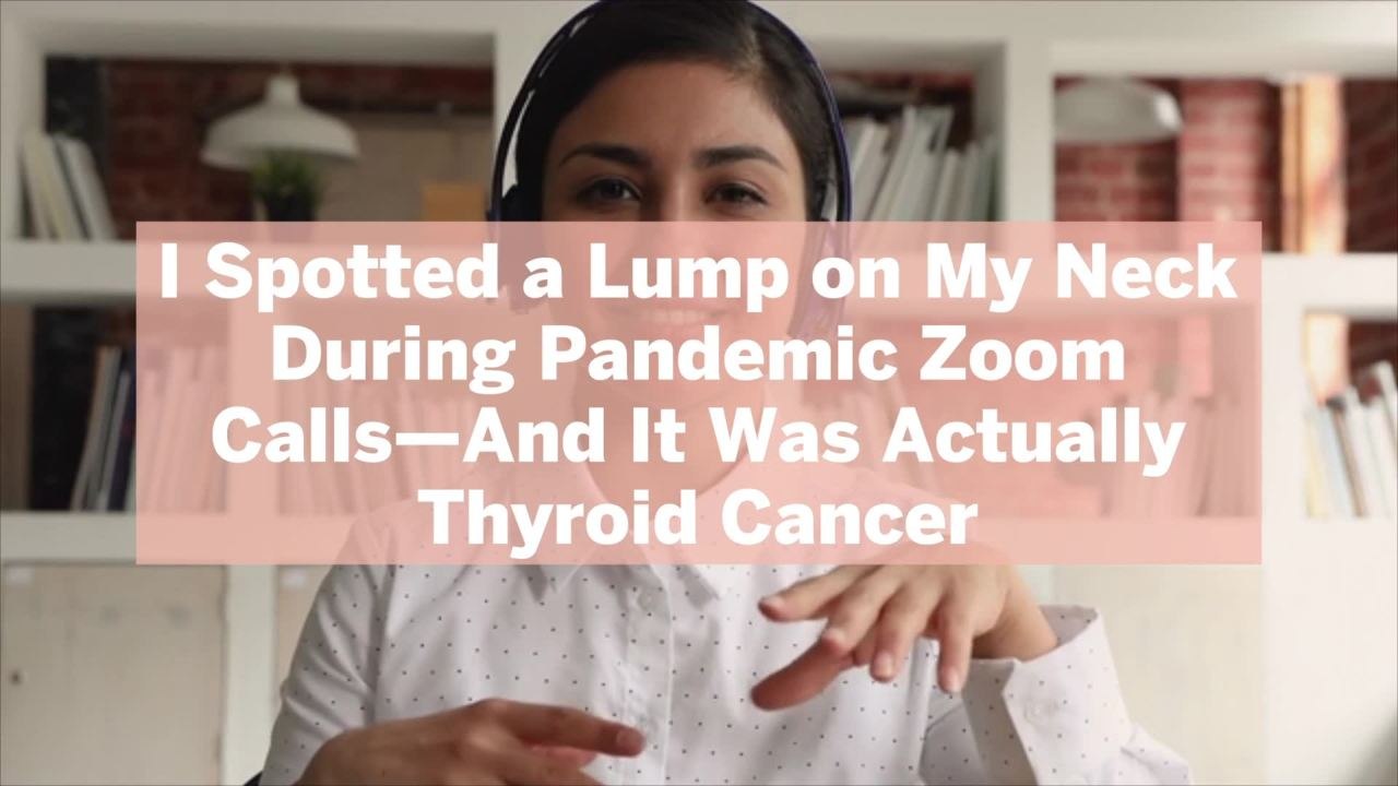 I Spotted a Lump on My Neck During Pandemic Zoom Calls—And It Was Actually Thyroid Cancer