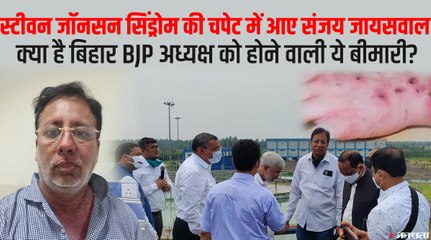 Bihar बीजेपी अध्यक्ष Sanjay Jaiswal  को हुई  स्टीवन जॉनसन सिंड्रोम बिमारी, जानिए क्या है ये बीमारी कैसे फैलती है?