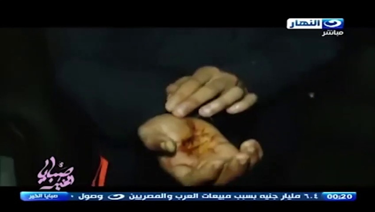 بنت تضحي بأغلى ما تملك من أجل خطيبها والنهاية كارثيه