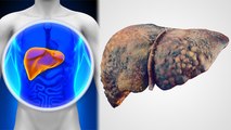 Liver खराब होने पर Body में दिखते है ये Symptoms, Doctors Alert | Boldsky