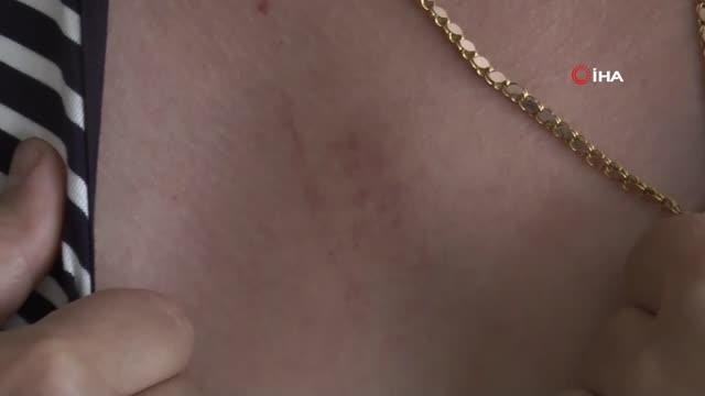 Eski erkek arkadaş dehşeti...Darp edilip seyir halindeki araçtan atılan kadın konuştu