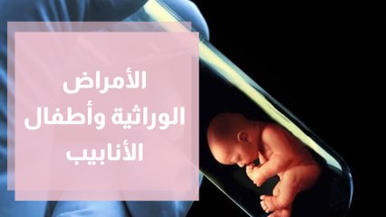 علاج الأمراض الوراثية بمساعدة أطفال الأنابيب