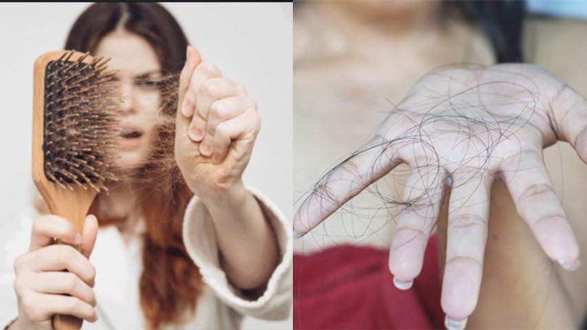 Hair Fall रोकने का असरदार नुस्खा। गंजे होते सिर पर भी आने लगेंगे बाल | Hair Fall Solution