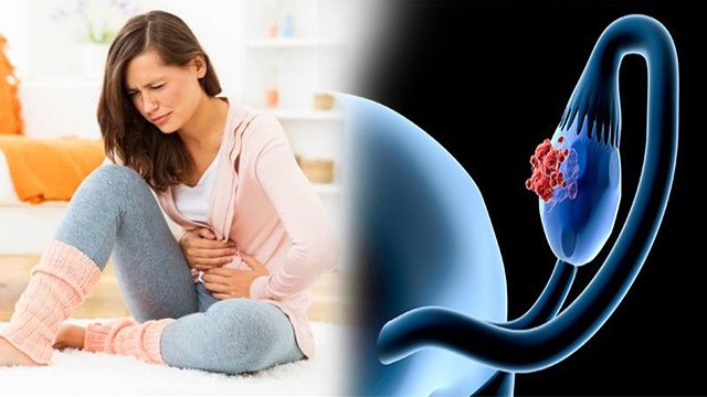 Females में Ovarian Cancer Symptoms चौंक देंगे | Ovarian Cancer Symptoms | Boldsky