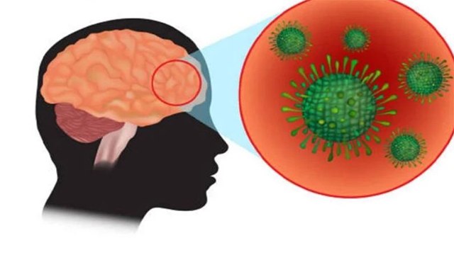 Nipah Virus ने बढ़ाई अब Doctors की चिंता, जानें Symptoms और Precautions | Boldsky