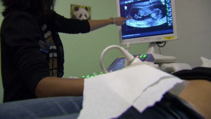 美 낙태권 논쟁 연일 확산..."텍사스 보이콧" / YTN