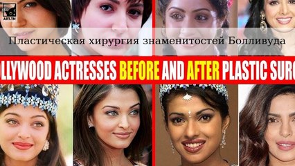 Знаменитости Болливуда до и после предполагаемой пластической операции