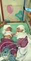 Gémeas siamesas olham-se pela primeira vez após cirurgia de separação