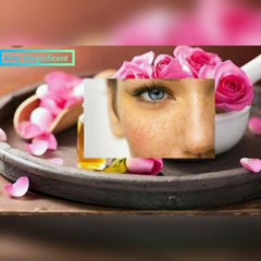 Hyperpigmentation,Melasma, darkspots diy remedy 100%effective
