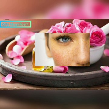 Hyperpigmentation,Melasma, darkspots diy remedy 100%effective