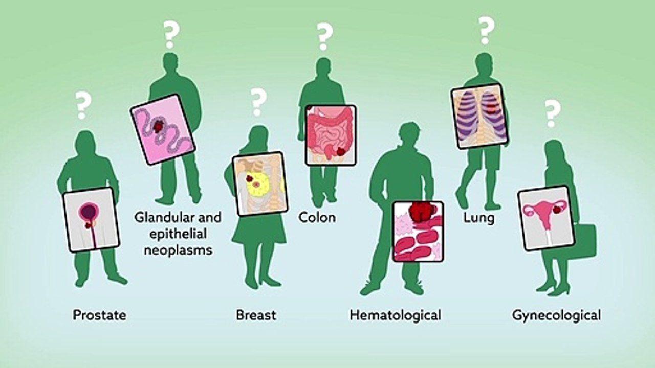 Exercise benefits for cancer patients don_t depend on cancer type(720P_HD)تمارين لمرضي السرطان الشجعان الاقوياء