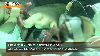[자막뉴스] "팔팔하게 자라다오"…288g 초미숙아 엄마 품으로