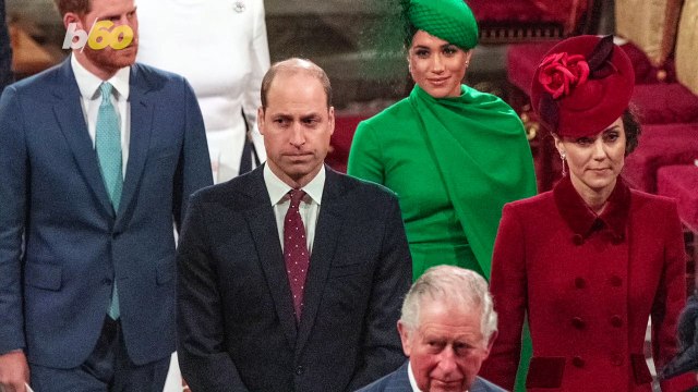 Lifetime's 'Prince William' Painted As Villain, Actor Added a Bald Patch to His Head