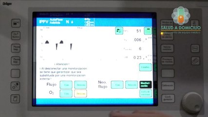 Configuración Básica de Calibración Dräger Evita 4
