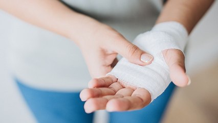 Atasi Luka Bakar Ringan dengan Bahan-bahan Ini