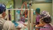 Des médecins séparent des jumelles siamoises en Israël