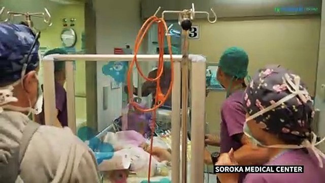 Des médecins séparent des jumelles siamoises en Israël