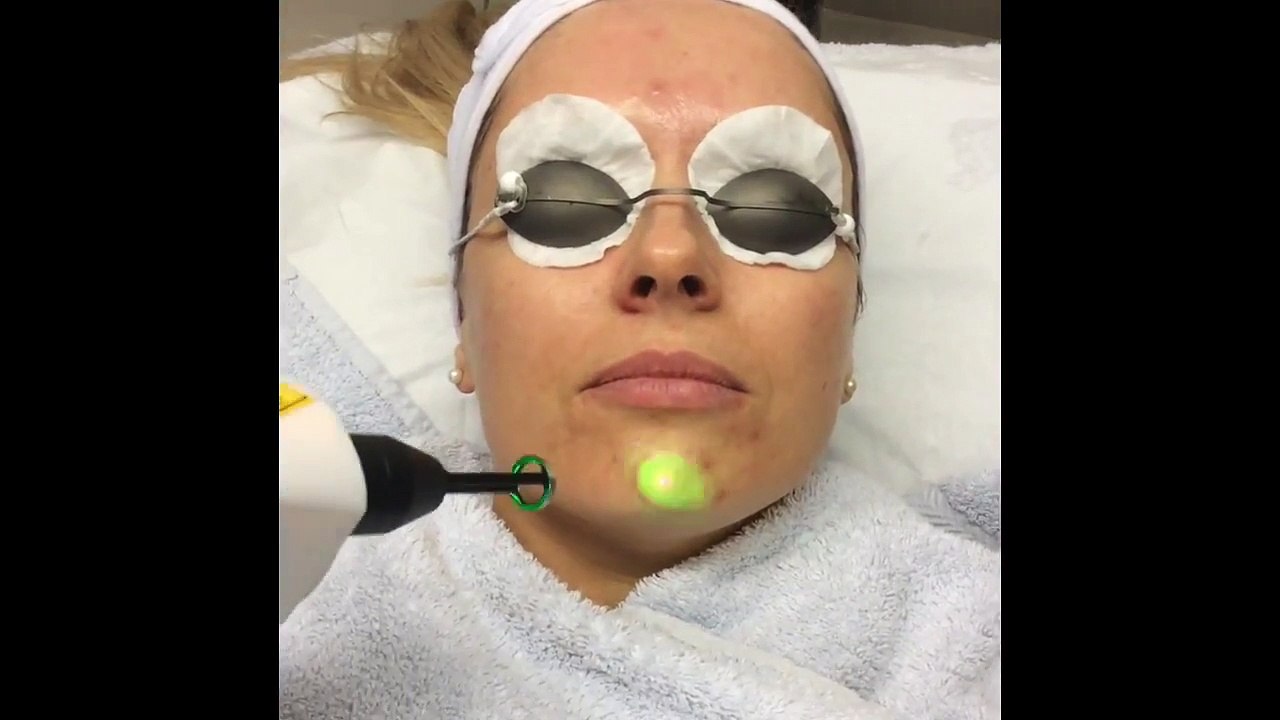 Laser & Light Facial