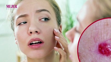 Conoce más sobre los lunares rojos I Mujer  - Nex Panamá